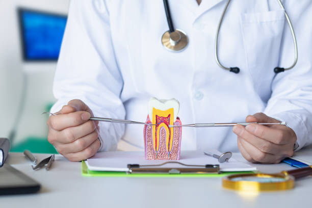 Best Knocked-Out Tooth (Avulsed Tooth) Treatment in Fort Dick, CA