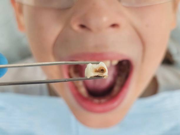 Best 24-Hour Emergency Dental Care in Fort Dick, CA
