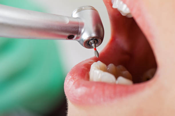 Best Weekend Emergency Dental Services in Fort Dick, CA